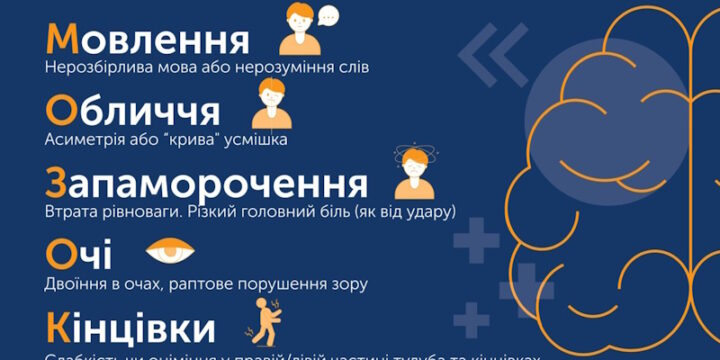 Знай ознаки інсульту